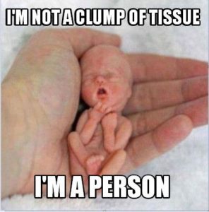 Fetus is a Person
